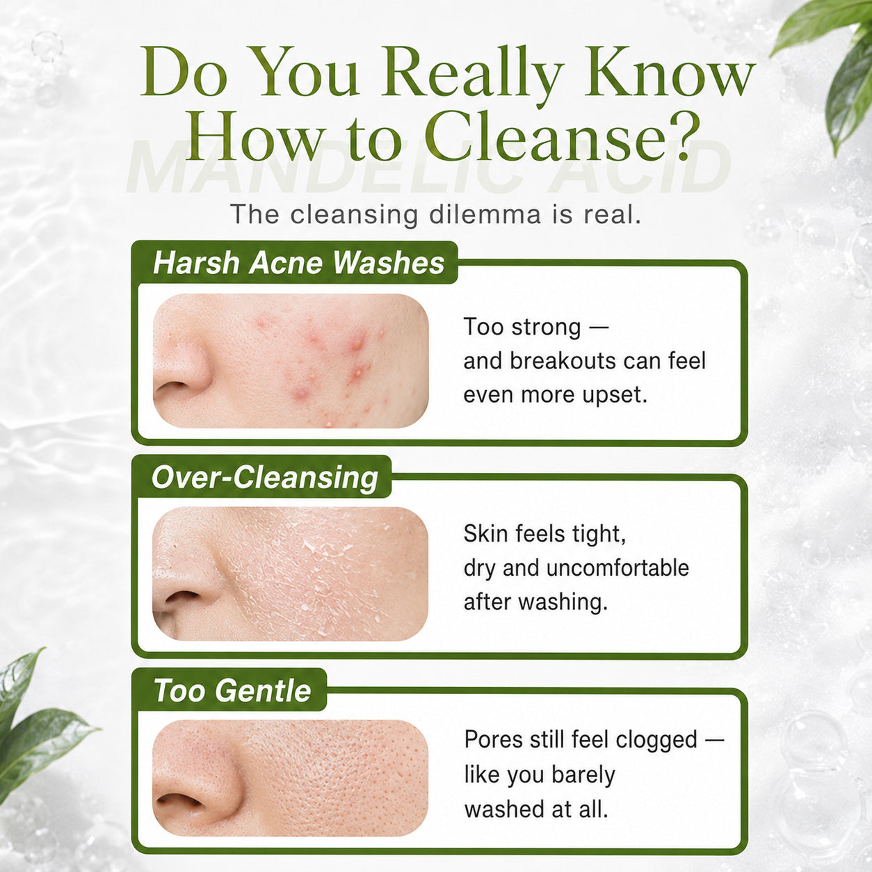 Dr.Douxi mandelic cleanser pain point stripped tight skin versus never feels clean